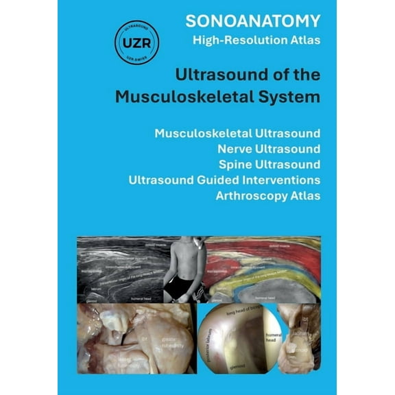 Sonoanatomy - High-Resolution Atlas - Ultrasound of the Musculoskeletal System: Musculoskeletal Ultrasound, Nerve Ultras, (Paperback)