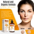 thumbnail image 3 of Dermaxgen® PURE ORGANIC Vitamin C 20% + Retinol + Hyaluronic Acid ANTI-AGING SERUM - 8 FL OZ, 3 of 8
