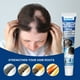 thumbnail image 2 of Sophora flavescens alopecia areata Crema Cuidado de la Piel de la Cabeza Crema Cuidado Del Cabello, 2 of 12