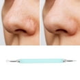 thumbnail image 5 of Unique Bargains 1 Pc Spiral Pimple Extractor Green 7.08", 5 of 7