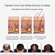 thumbnail image 4 of Spray Nutritivo y Crecimiento Rápido Del Cabello Hot6sl 50 ml, 4 of 7
