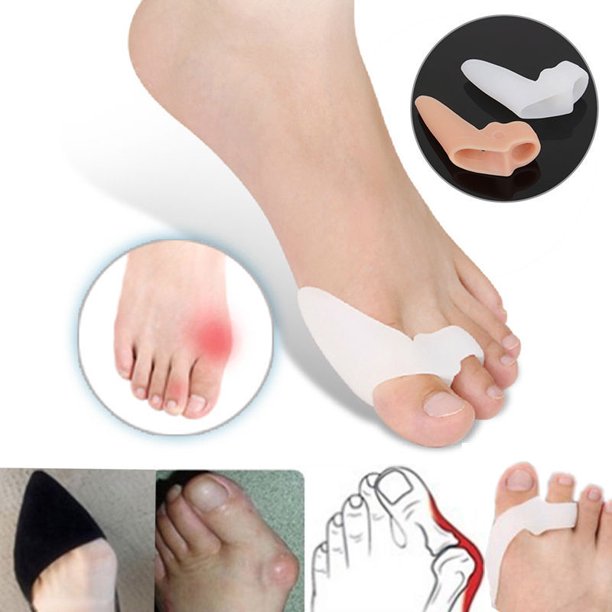 Yosoo Foot Toe Protector Pad,2 x Gel Silicone Bunion Corrector Foot Toe Protector Pad