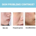 thumbnail image 1 of 2pcs Blue Tansy Cleanser, Deep Oil Control Delicate Brightening, Firming And Cleansing Pores, 1 of 5