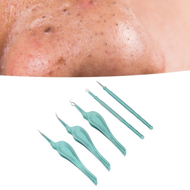 Herramienta removedora de espinillas kit de herramientas extractor de comedones portátil caja de almacenamiento de acero inoxidable pinzas de puntas finas para el hogar ANGGREK Otros