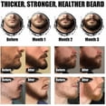 thumbnail image 5 of Complete Men's Beard Kit Men's Beard Care Kit with Beard Roller Contains Beard Shampoo, Beard Oil, Beard Creams, Beard Comb, Beard Brush, Beard Scissors, Razor, Beard Blades, 5 of 5