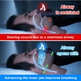 thumbnail image 2 of Adjcomtable Anti Snoring Mouthpiece Device Snoring Stopper Teeth Mouthguard Sleeping Aid Guard Bruxism Stop Snoring Improve Sleep, 2 of 6
