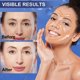 thumbnail image 3 of Cinta facial antiarrugas TEAWOO para estiramiento miofascial facial, 2 rollos, 3 of 7