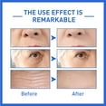 thumbnail image 5 of Xerdsx 2023 Newest Face Serum, Instant Face Lift Cream, Hydrating Face Serum, Dark Spot Corrector & Anti-Aging Collagen Serum for Women, Fade Fine Lines Essence 30ml, 5 of 7