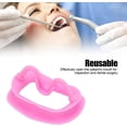 thumbnail image 2 of Abridor de boca de 2 piezas, encogimiento de boca de silicona reutilizable para juego de desafío de protector bucal de examen oral (rosa), 2 of 5