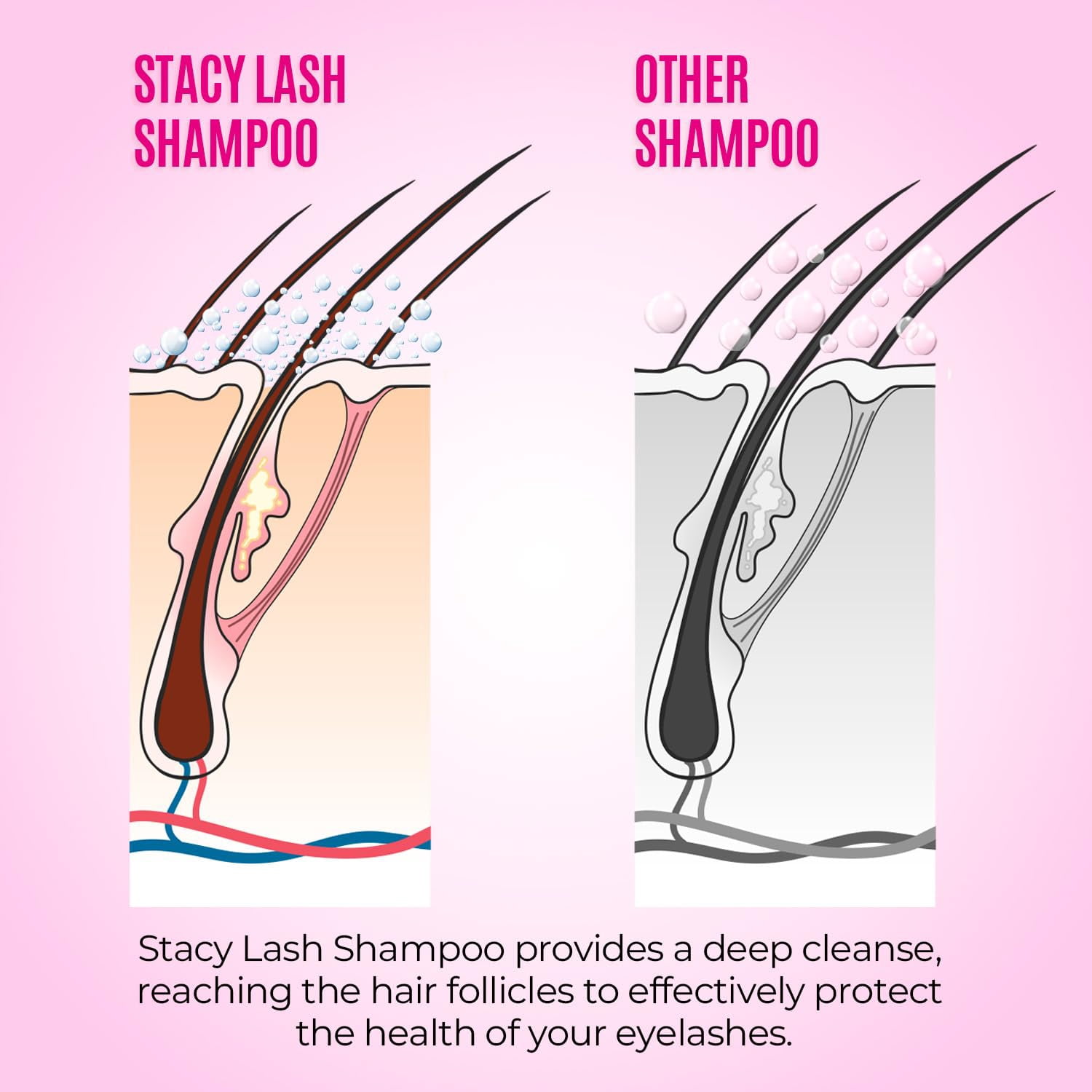 STACY LASH Lash Shampoo Kit Foaming Cleanser Eyelash Grooming Kit Includes Eye Lash Spoolies, Rinse Bottle, Cleansing Pad
