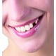 thumbnail image 4 of Reparación de encías con dientes sólidos Brackets caseros para dentaduras postizas Brackets de vampiro Brackets de tigre, 4 of 5