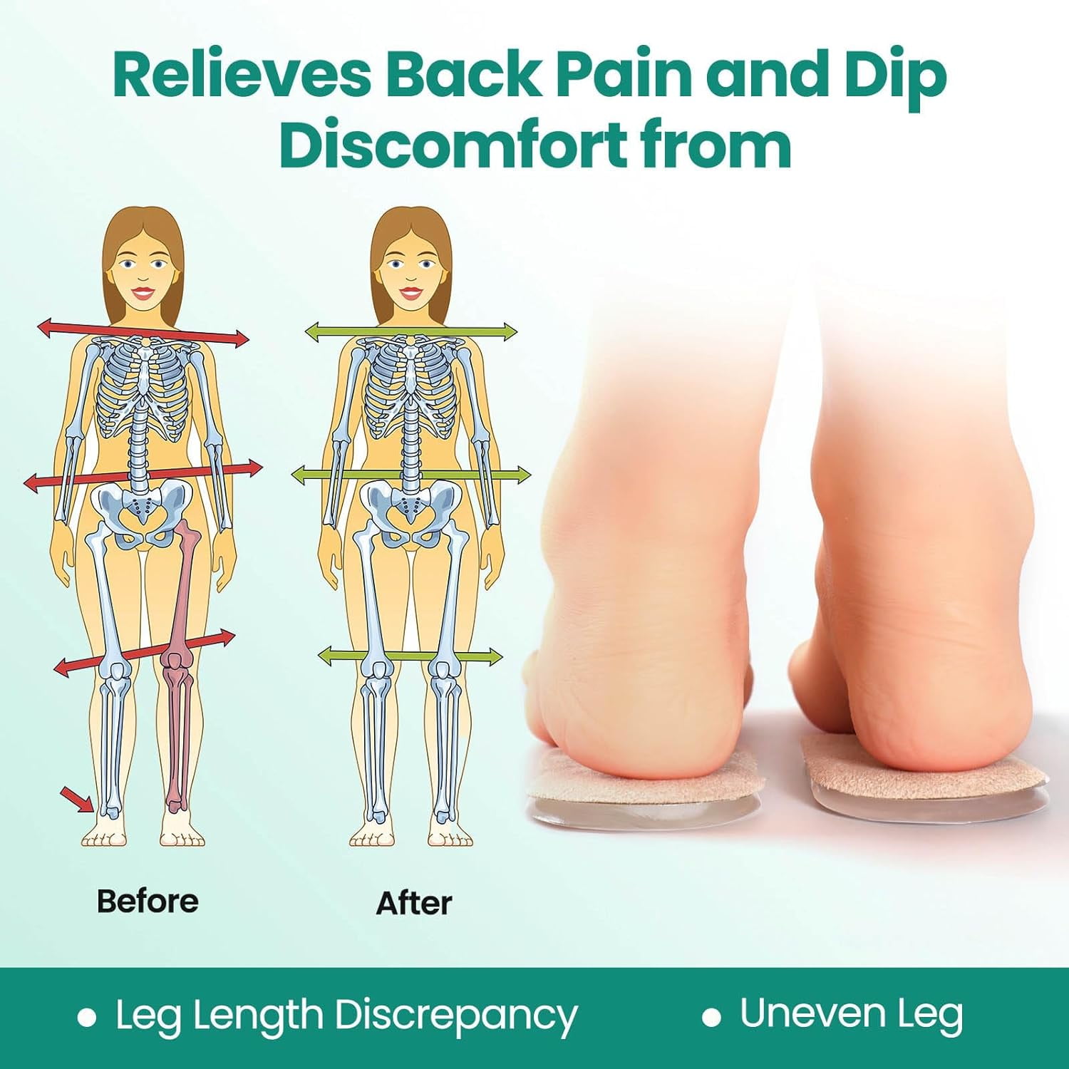 Leg Length Discrepancy Heel Lifts For Plantar Fasciitis SIIHEA
