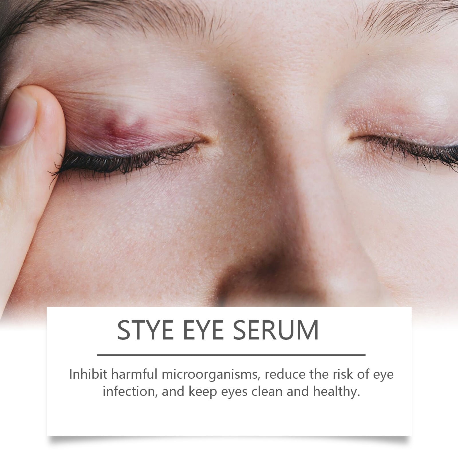 Deep Cleansing Caring For Eye Health Choose Our Eye Wash For Instant Of Eye Fatigue And Of Bright Eyes [30ML]