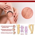 thumbnail image 4 of Crema para aliviar el dolor de 20g uso externo de la piel venas varicosas yeso para el cuidado del cuerpo Ndcxsfigh Cuidado Belleza, 4 of 9
