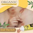 thumbnail image 5 of Crema a base de hierbas china Natural, crema curativa a base de hierbas para Eczema orgánico, crema facial, crema corporal, pomada antipicazón, uso externo, 5 of 5