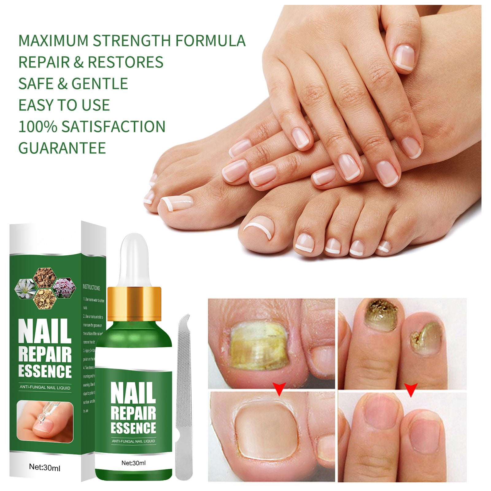 Alvantor Toenail Fungus Treatment Serum - Nail Repair Essence, 1.01 fl oz