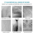 thumbnail image 5 of Skin Repair Healing Scar Cream Remove Burns Cuts Ointment Powerful Stretch Marks, 5 of 5