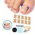 thumbnail image 4 of 60x as De Uñas Encarnadas Herramienta De Corrección De Pedicura De Uñas Pies, 4 of 9