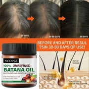 Mooyam 3 Pack Batana Hair Oil for Women & Men - 100% Pure and Natural Batana Oil - Repair Damage Hair - Restore Hair Health 12.15FLOZ