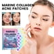 thumbnail image 2 of Medicated Acne Patches For All Skin Types, SpotStickers For Face And Skin To Get Ridof Pimples And Pimples,72pcs, 2 of 9