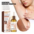 thumbnail image 1 of Fiudx Liquidación de ahorros de verano Abrillantador articulaciones, blanqueamiento de axilas, codo, blanqueamiento de la piel, suero de eliminación de melanina de rodilla, 50ml, 1 of 7