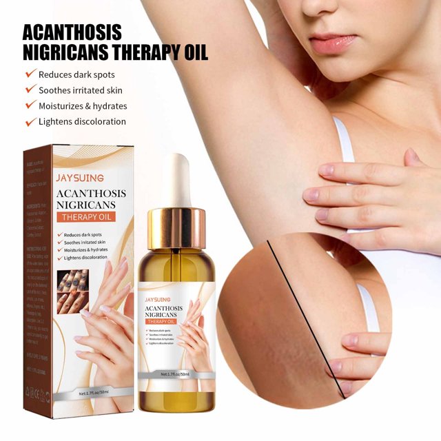 Fiudx Liquidación de ahorros de verano Abrillantador articulaciones, blanqueamiento de axilas, codo, blanqueamiento de la piel, suero de eliminación de melanina de rodilla, 50ml