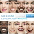 thumbnail image 6 of Ashosteey Teeth Whitening Pen,No Sensitivity Teeth Whitening Gel, Effective Teeth Whitener, Travel-Friendly Tooth Whitening Pen, Carbamide Peroxide Tooth Bleaching Gel for Adults,White Smile, 6 of 9