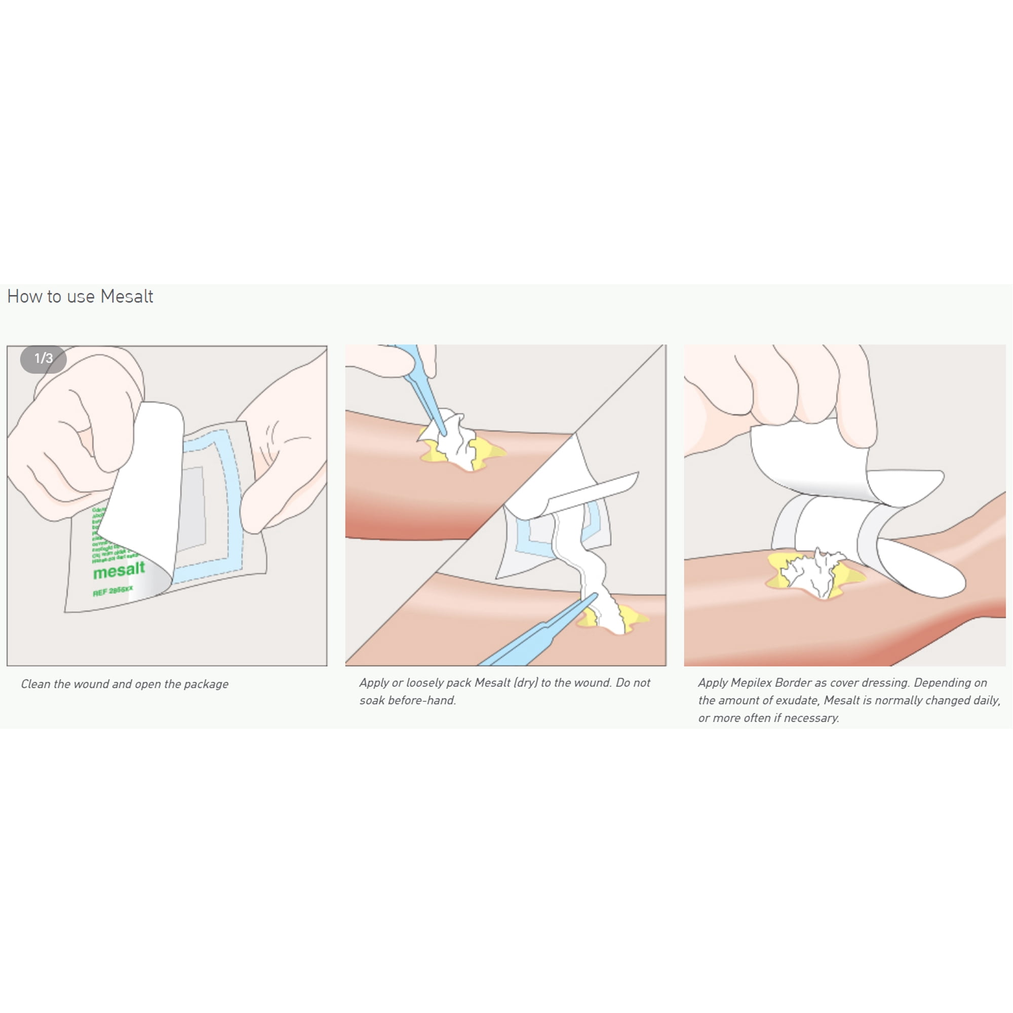 Mesalt Sodium Chloride Impregnated Dressing 4 x 4" / 2 x 2" Folded Square Gauze 285580 240 Ct