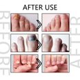 thumbnail image 5 of FeiKong Acondicionador para el crecimiento y fortalecimiento de las uñas Onycholysis Heal, Tratamiento de uñas Onycholysis, Tratamiento Onycholysis, Onycholysis Heal, 5 of 5