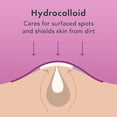 thumbnail image 4 of Pimple Patches Rael Miracle Overnight Spot, 52 unidades, 4 of 9