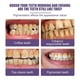 thumbnail image 5 of Polvo blanqueador de dientes - Dientes limpios, blanqueamiento, efecto de limpieza básico, refresca el aliento, 50 ml, polvo dental con protector bucal, pasta de dientes blanqueadora, 5 of 5