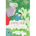 thumbnail image 1 of Vitiligo Blanco, 1 of 2