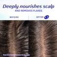 Head & Shoulders Scalp Restore Anti-Dandruff Nourishing, for Dry, Flaky ...