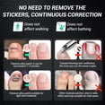 thumbnail image 2 of Titanium Alloy Ingrown Toenail Corrector & Pain Relief Aid - Specially Designed Ingrown Toenail & Corrector Removal Kit for Curved Nail Repair and Removal (0.59/0.67in), 2 of 6
