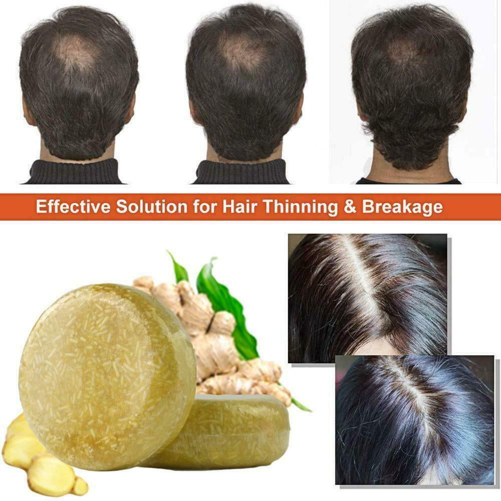 Anti Hair Loss Shmpoo Organic Ginger Shampoo Bar Soap Hair Growth Care Soap Lazada PH | Organic Ginger Shampoo Bar Anti Hair Loss Shmpoo Soap Hair Growth Care Soap Anti Hair Loss Shmpoo Organic Ginger Shampoo Bar Soap Hair Growth Care Soap Lazada PH | Organic Ginger Shampoo Bar Anti Hair Loss Shmpoo Soap Hair Growth Care Soap