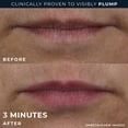 thumbnail image 4 of Tratamiento voluminizador de labios RoC Derm Correxion, 4 of 8
