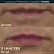 thumbnail image 4 of Tratamiento voluminizador de labios RoC Derm Correxion, 4 of 8