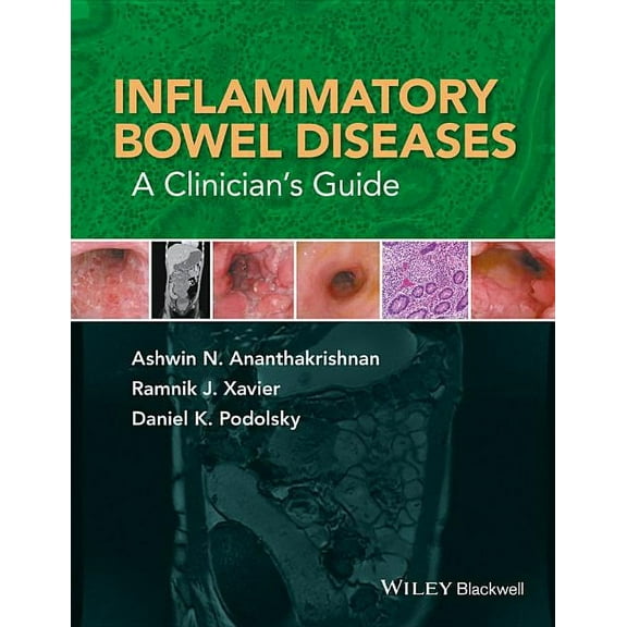 Inflammatory Bowel Diseases: A Clinician's Guide (Hardcover)