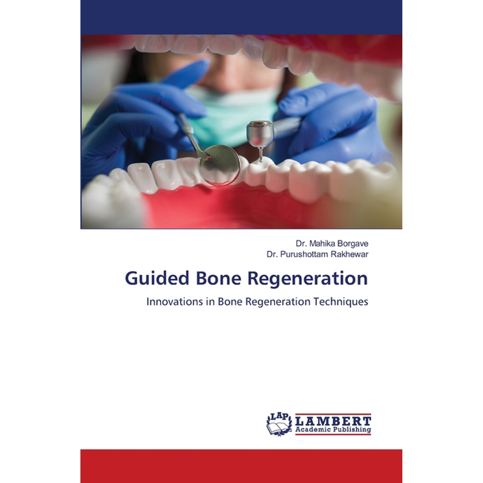 Guided Bone Regeneration (Paperback)