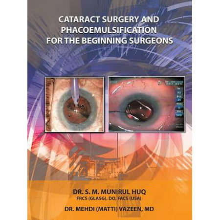 Cataract Surgery and Phacoemulsification for the Beginning