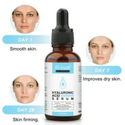 Elbbub Hyaluronic Acid Serum for Face 90ml, Moisturizing and Hydrating Serum for Rough Skin,Reduce Fine Lines & Inflammation,Fast Absorption,Non Greasy