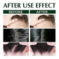 thumbnail image 4 of Head Moss Anti-Itching Shampoo Hair Oil Control Scalp Cleaning Anti-Dandruff Anti-Itching Refre, 4 of 4