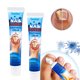 thumbnail image 1 of Crema para eliminar hongos en las uñas, onicomicosis, tratamiento de uñas con hongos, Paronych, 1 of 8
