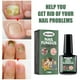 thumbnail image 2 of Solución para el cuidado de las uñas de los pies, tratamiento para uñas dañadas, renueva las uñas de los pies y los pies dañados y descoloridos, 15 ml, 2 of 4