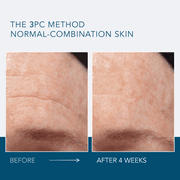 Lancer The Method Cleanse Normal Combination Skin Cleanser, 4.05 fl oz