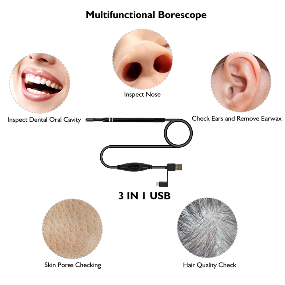 Clear Out Your Ears With the GPEESTRAC Ear Wax Removal Otoscope