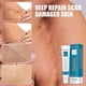 thumbnail image 1 of Crema reparadora de cicatrices, cicatrices de acné, Gel para eliminar las estrías, manchas de acné, tratamiento quirúrgico para cicatrices, 1 of 2
