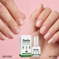 thumbnail image 5 of Transparent Nail Care Oil Moisturizes And Comforts The Nail Keeps It Dry And Moist Gives It A Natural And Provides Gentle Care 15ml, 5 of 9