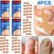 thumbnail image 5 of Parche para Uñas 20 Piezas Reparación Indoloro Y Transpirable Dolor Uce Uso Diario Rojo, 5 of 8
