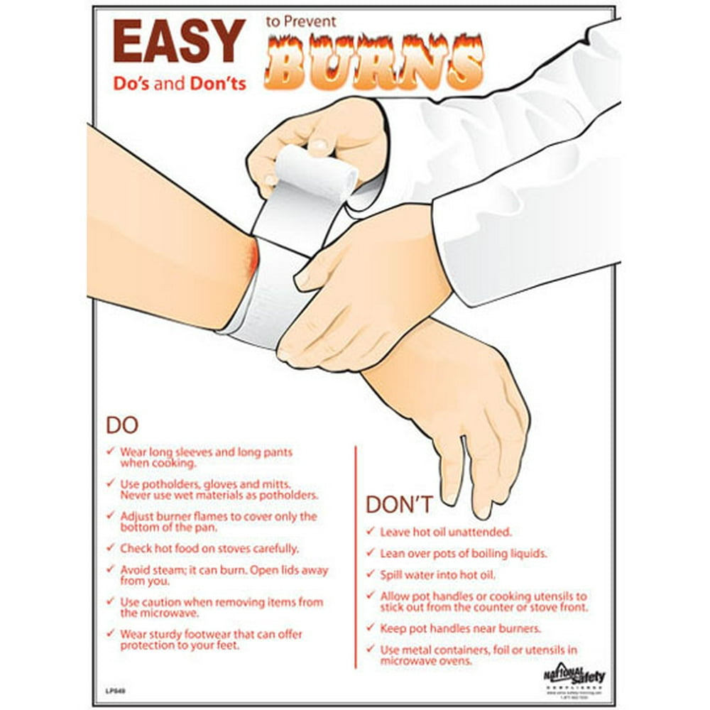 Prevent Burns Poster (18 by 24 inch)
